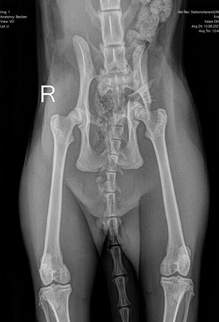 Röntgenaufnahmen unmittelbar vor (oben) der Operation