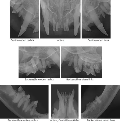 Auf Zahnröntgenbildern sieht man alle Veränderungen und Schäden an Kiefer und Zähnen.