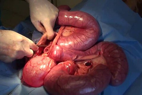 Vorverlagerte, eitergefüllte Gebärmutter während der Ovariohysterektomie. Vorverlagerte, eitergefüllte Gebärmutter während der Ovariohysterektomie.