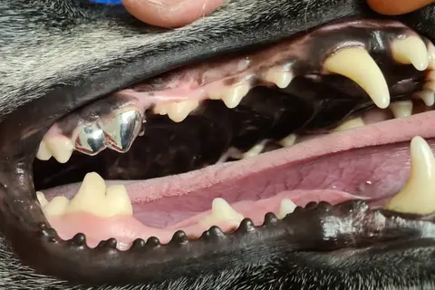 Mittlerweile ist sogar das Überkronen von Zähnen möglich. 